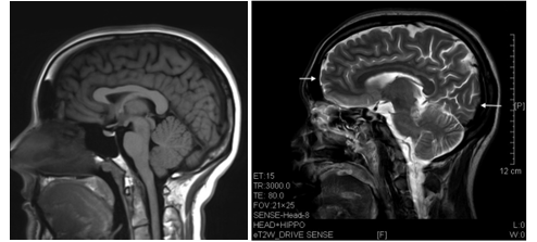 cd361fe3c55f5f7cf3651f0d5d769f99