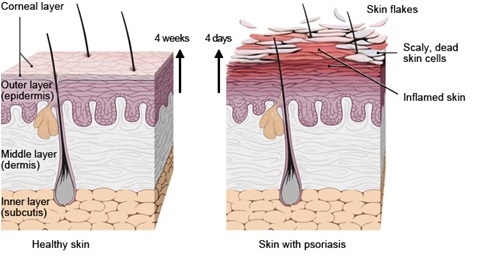fig 1 healthy vs abnormal skin cell